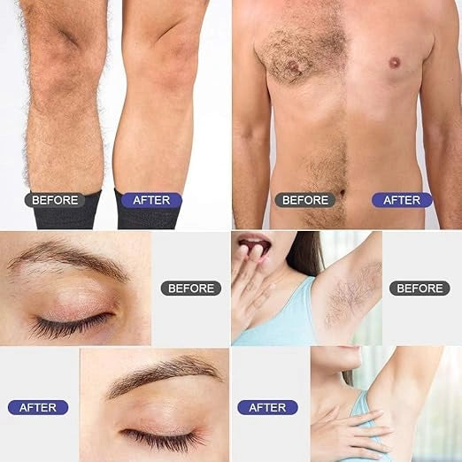 Vinmall wax warmer hair removal kit including wax pot and essential accessories for professional waxing at home