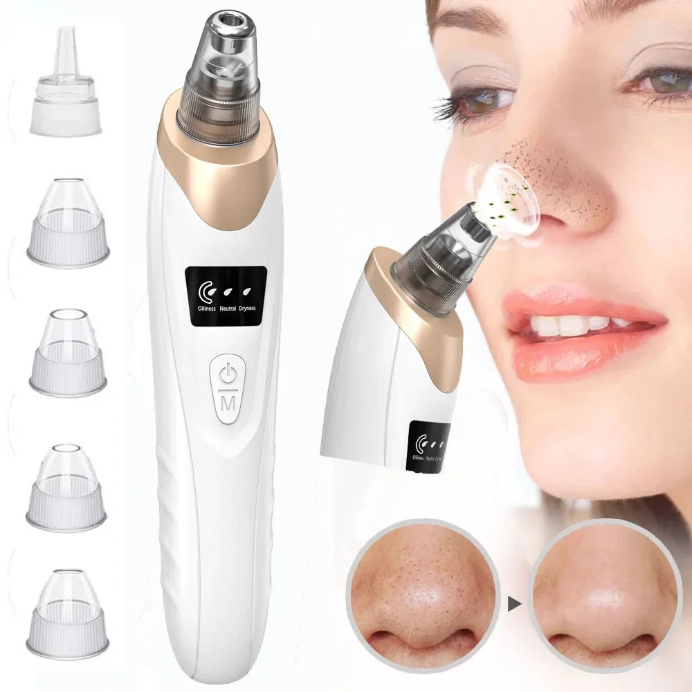 Zomo electric blackhead remover vacuum featuring interchangeable suction heads for customized skincare treatments